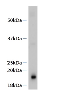 SVR4 | Supressor of variegation 4 in the group Antibodies Plant/Algal / Photosynthesis / Biogenesis/architecture at Agrisera AB (Antibodies for research) (AS13 2725)